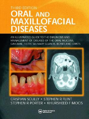 Oral and Maxillofacial Diseases: An Illustrated Guide to Diagnosis and Management of Diseases of the Oral Mucosa, Gingivae, Teeth, Salivary Glands, Bones, and Joints - Scully, Crispian, Dean, MD, PhD, and Flint, Stephen R, and Porter, Stephen R