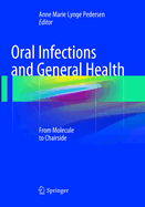 Oral Infections and General Health: From Molecule to Chairside