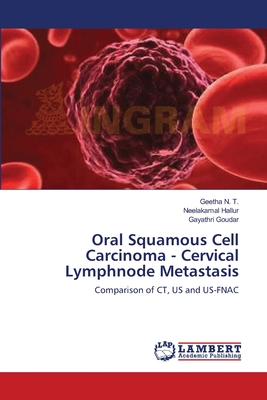 Oral Squamous Cell Carcinoma - Cervical Lymphnode Metastasis - N T, Geetha, and Hallur, Neelakamal, and Goudar, Gayathri