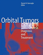 Orbital Tumors: Diagnosis and Treatment