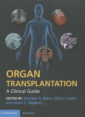 Organ Transplantation: A Clinical Guide - Klein, Andrew A. (Editor), and Lewis, Clive J. (Editor), and Madsen, Joren C. (Editor)