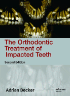 Orthodontic Treatment of Impacted Teeth, Second Edition - Becker, Adrian