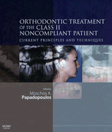 Orthodontic Treatment of the Class II Noncompliant Patient: Current Principles and Techniques
