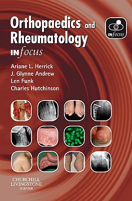 Orthopaedics and Rheumatology in Focus - Herrick, Ariane L, and Andrew, J Glynne, MD, and Funk, Lennard, BSC, Msc