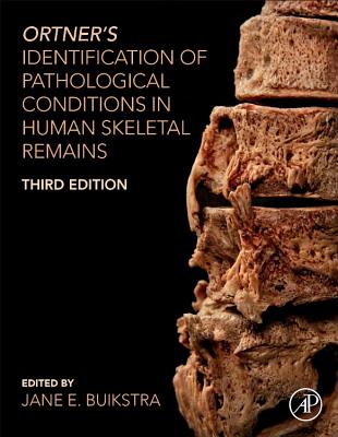 Ortner's Identification of Pathological Conditions in Human Skeletal Remains - Buikstra, Jane E. (Editor)