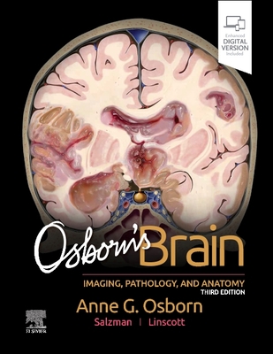 Osborn's Brain - Osborn, Anne G, MD, Facr, and Linscott, Luke L, MD, and Salzman, Karen L, MD