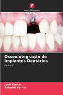 Osseointegra??o de Implantes Dentrios