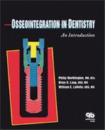 Osseointegration in Dentistry: An Introduction - Worthington, Philip