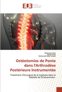 Ost?otomies de Ponte dans l'Arthrod?se Post?rieure Instrument?e