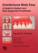 Overdentures Made Easy: A Guide to Implant and Root Supported Prostheses