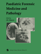 Paediatric Forensic Medicine and Pathology