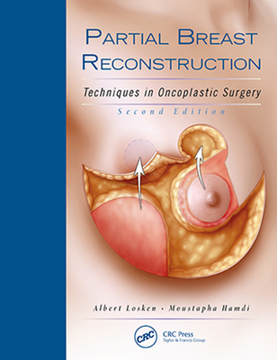 Partial Breast Reconstruction: Techniques in Oncoplastic Surgery - Losken, Albert (Editor), and Hamdi, Moustapha (Editor)
