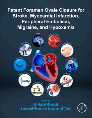 Patent Foramen Ovale Closure for Stroke, Myocardial Infarction, Peripheral Embolism, Migraine, and Hypoxemia - Mojadidi, M. Khalid, MD (Editor), and Meier, Bernhard (Editor), and Tobis, Jonathan M. (Editor)