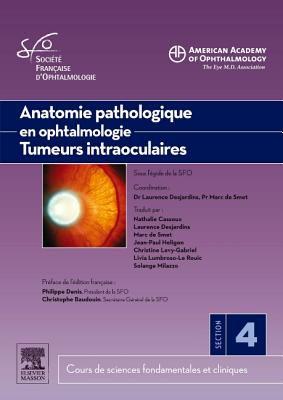 Patho. Ophtalmiques Tumeurs Intraoculaires - American Academy of Ophthalmology (Aao), and Societe Francaise D'Ophtalmologie (Sfo), and De Smet, Marc D