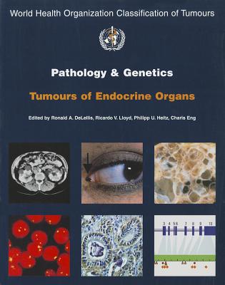 Pathology and Genetics of Tumours of Endocrine Organs [op] - The International Agency for Research on Cancer, and Delellis, R (Editor), and Lloyd, Ricardo V (Editor)