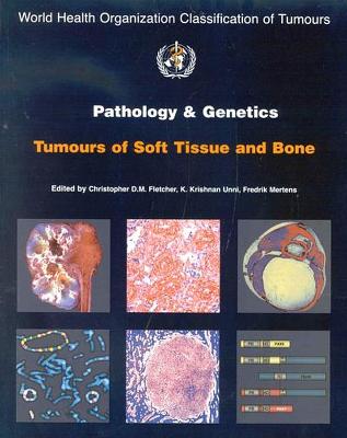 Pathology and Genetics of Tumours of Soft Tissue and Bone - Who, and IARC, and The International Agency for Research on Cancer