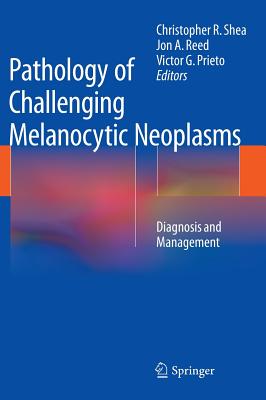 Pathology of Challenging Melanocytic Neoplasms: Diagnosis and Management - Shea, Christopher R (Editor), and Reed, Jon A (Editor), and Prieto, Victor G, MD, PhD (Editor)