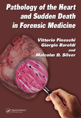 Pathology of the Heart and Sudden Death in Forensic Medicine - Fineschi, Vittorio, and Baroldi, Giorgio, and Silver, Malcolm D