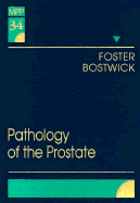 Pathology of the Prostate: Volume 34 in the Major Problems in Pathology Series Volume 34