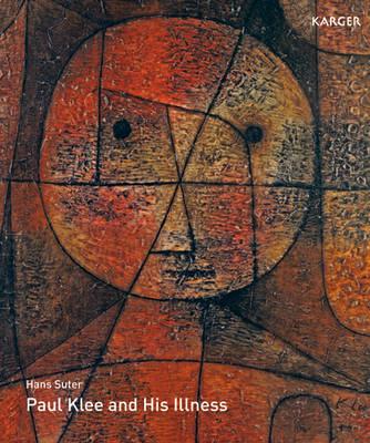 Paul Klee and His Illness - Suter, Hans