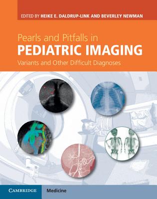 Pearls and Pitfalls in Pediatric Imaging: Variants and Other Difficult Diagnoses - Daldrup-Link, Heike E. (Editor), and Newman, Beverley (Editor)