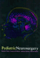 Pediatric Neurosurgery - Choux, Maurice, and Di Rocco, Concezio, and Walker, Marion L, MD
