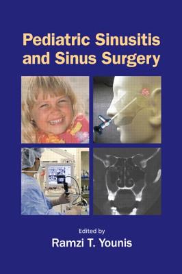 Pediatric Sinusitis and Sinus Surgery - Younis, Ramzi T (Editor)