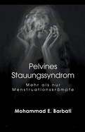 Pelvines Stauungssyndrom - Mehr als nur Menstruationskr?mpfe