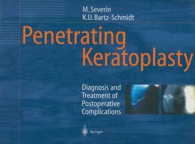 Penetrating Keratoplasty: Diagnosis and Treatment of Postoperative Complications - Severin, Maria, and Bartz-Schmidt, Karl-Ulrich