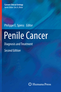 Penile Cancer: Diagnosis and Treatment