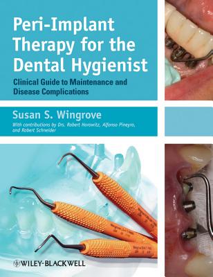 Peri-Implant Therapy for the Dental Hygienist: Clinical Guide to Maintenance and Disease Complications - Wingrove, Susan S