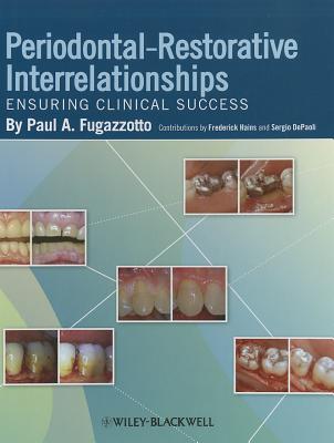 Periodontal-Restorative Interrelationships: Ensuring Clinical Success - Fugazzotto, Paul A, and Hains, Frederick (Contributions by), and Depaoli, Sergio (Contributions by)