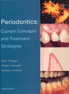 Periodontics: Current Concepts and Treatment Strategies