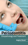 Periodontitis: Etiopathology and Treatment