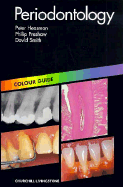 Periodontology: Colour Guide