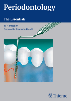 Periodontology: The Essentials - Mueller, Hans-Peter