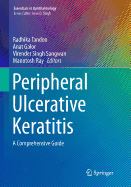 Peripheral Ulcerative Keratitis: A Comprehensive Guide
