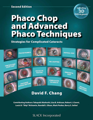 Phaco Chop and Advanced Phaco Techniques: Strategies for Complicated Cataracts - Chang, David F, MD