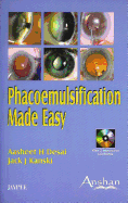 Phacoemulsification Made Easy