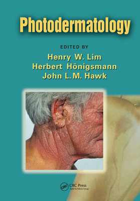 Photodermatology - Lim, Henry W. (Editor), and Honigsmann, Herbert (Editor), and Hawk, John L. M. (Editor)