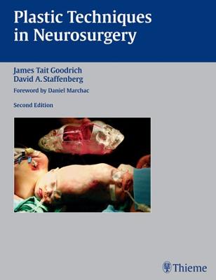 Plastic Techniques in Neurosurgery - Goodrich, James Tait (Editor), and Staffenberg, David (Editor)