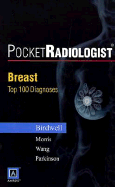 Pocketradiologist - Breast: Top 100 Diagnoses