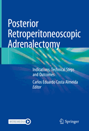 Posterior Retroperitoneoscopic Adrenalectomy: Indications, Technical Steps and Outcomes