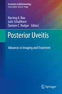Posterior Uveitis: Advances in Imaging and Treatment
