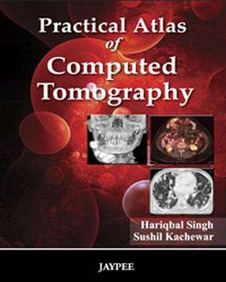 Practical Atlas of Computed Tomography - Singh, Hariqbal, and Kachewar, Sushil