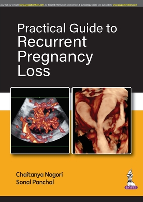 Practical Guide to Recurrent Pregnancy Loss - Nagori, Chaitanya, and Panchal, Sonal