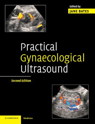 Practical Gynaecological Ultrasound - Bates, Jane, Mphil (Editor)