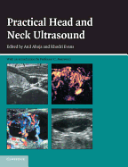 Practical Head & Neck Ultrasound