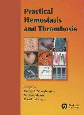 Practical Hemostasis and Thrombosis - O'Shaughnessy, Denise (Editor), and Makris, Michael (Editor), and Lillicrap, David (Editor)