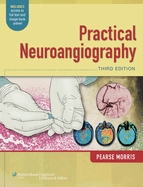 Practical Neuroangiography with Access Code